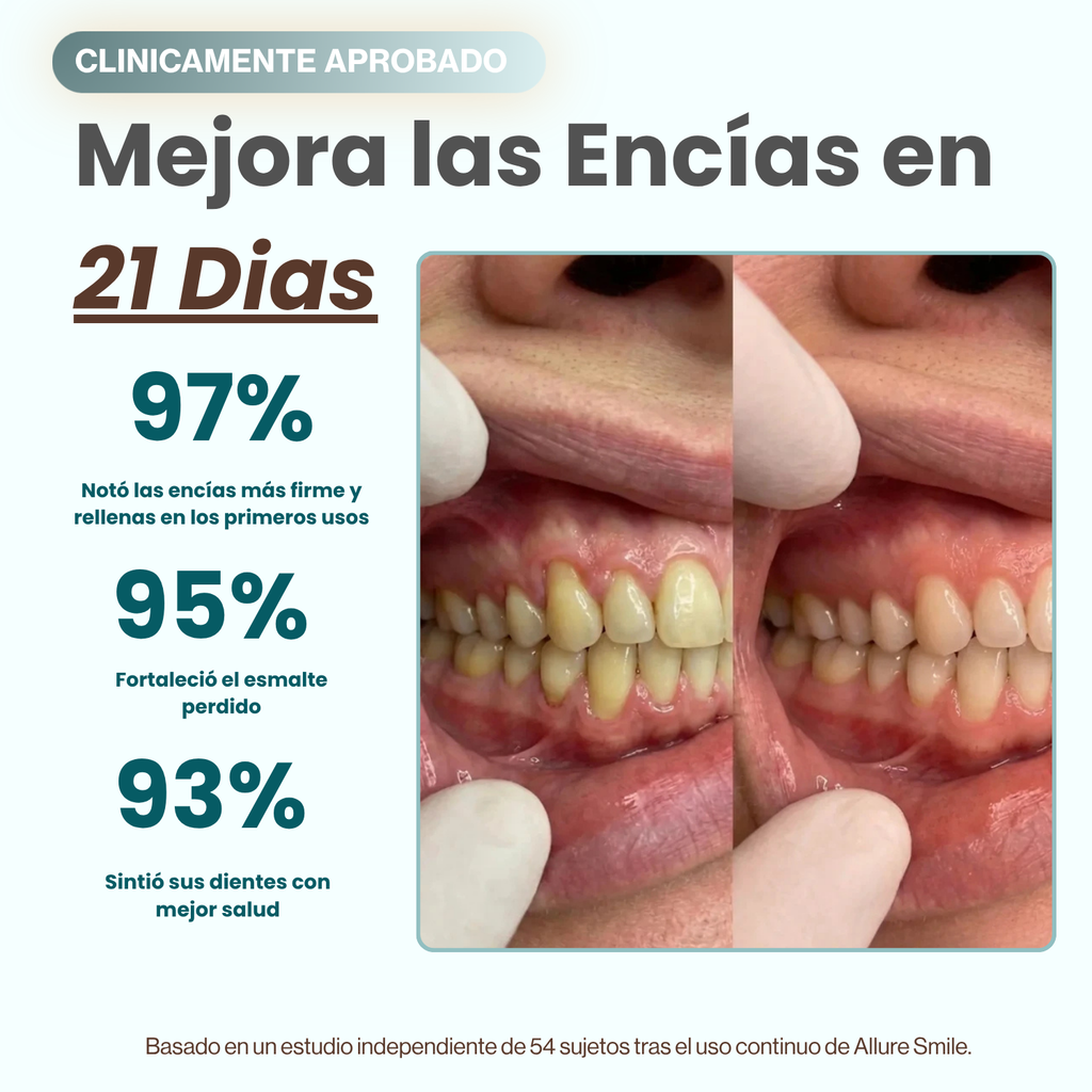 AlureSmile™ | Solución de Encías