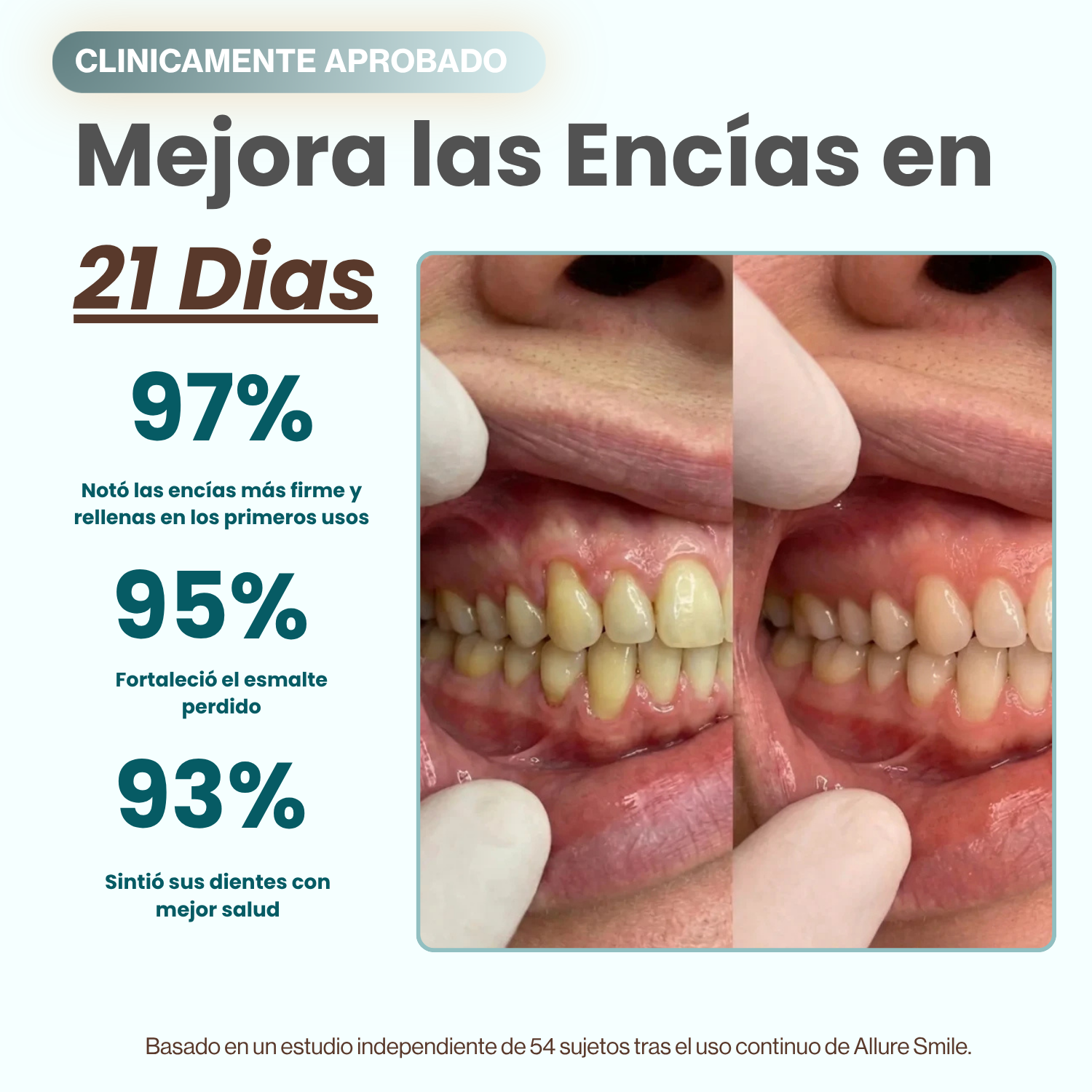 AlureSmile™ | Solución de Encías