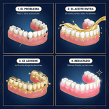 AlureSmile g03_4panel